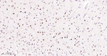 SF3B1 Antibody in Immunohistochemistry (Paraffin) (IHC (P))