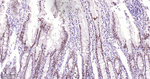 SF3B1 Antibody in Immunohistochemistry (Paraffin) (IHC (P))