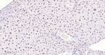 SF3B1 Antibody in Immunohistochemistry (Paraffin) (IHC (P))