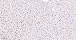 SF3B1 Antibody in Immunohistochemistry (Paraffin) (IHC (P))