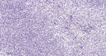 SF3B1 Antibody in Immunohistochemistry (Paraffin) (IHC (P))