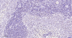 SF3B1 Antibody in Immunohistochemistry (Paraffin) (IHC (P))
