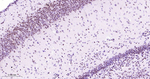 SF3B1 Antibody in Immunohistochemistry (Paraffin) (IHC (P))