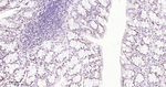 SF3B1 Antibody in Immunohistochemistry (Paraffin) (IHC (P))