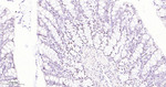 SF3B1 Antibody in Immunohistochemistry (Paraffin) (IHC (P))