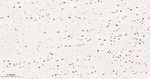SF3B1 Antibody in Immunohistochemistry (Paraffin) (IHC (P))