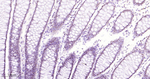 SF3B1 Antibody in Immunohistochemistry (Paraffin) (IHC (P))