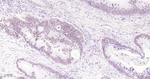 SF3B1 Antibody in Immunohistochemistry (Paraffin) (IHC (P))