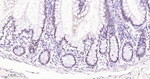 SF3B1 Antibody in Immunohistochemistry (Paraffin) (IHC (P))