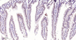 SF3B1 Recombinant Rabbit Monoclonal Antibody (5F6)