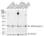 Septin 2 Recombinant Rabbit Monoclonal Antibody (1H6)