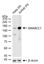 SMARCC1 Recombinant Rabbit Monoclonal Antibody (5B11)
