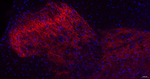 GAT-1 Antibody in Immunohistochemistry (Paraffin) (IHC (P))