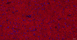 GAT-1 Antibody in Immunohistochemistry (Paraffin) (IHC (P))
