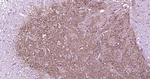 GAT-1 Antibody in Immunohistochemistry (Paraffin) (IHC (P))