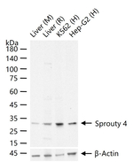 SPRY4 Recombinant Rabbit Monoclonal Antibody (8E5)