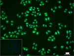 eIF4A3 Recombinant Rabbit Monoclonal Antibody (1B6)