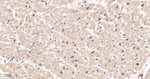 eIF4A3 Antibody in Immunohistochemistry (Paraffin) (IHC (P))
