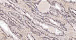 eIF4A3 Antibody in Immunohistochemistry (Paraffin) (IHC (P))