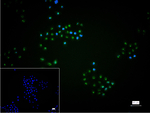 EXOSC7 Recombinant Rabbit Monoclonal Antibody (8G6)