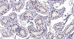 EXOSC7 Antibody in Immunohistochemistry (Paraffin) (IHC (P))