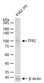TFR2 Antibody in Western Blot (WB)
