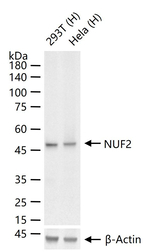 NUF2 Recombinant Rabbit Monoclonal Antibody (10B12)