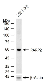 PARP2 Recombinant Rabbit Monoclonal Antibody (1B5)