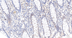 RCOR1 Antibody in Immunohistochemistry (Paraffin) (IHC (P))
