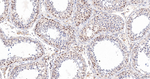 RCOR1 Antibody in Immunohistochemistry (Paraffin) (IHC (P))