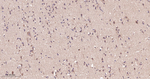 IRS2 Antibody in Immunohistochemistry (Paraffin) (IHC (P))