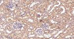 IRS2 Antibody in Immunohistochemistry (Paraffin) (IHC (P))