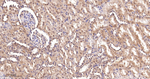 IRS2 Antibody in Immunohistochemistry (Paraffin) (IHC (P))