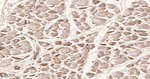 IRS2 Antibody in Immunohistochemistry (Paraffin) (IHC (P))