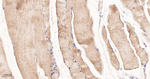 IRS2 Antibody in Immunohistochemistry (Paraffin) (IHC (P))