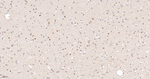 HIF1AN Antibody in Immunohistochemistry (Paraffin) (IHC (P))