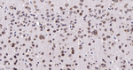 RANGAP1 Antibody in Immunohistochemistry (Paraffin) (IHC (P))