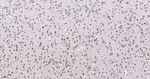 RANGAP1 Antibody in Immunohistochemistry (Paraffin) (IHC (P))