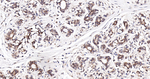 RANGAP1 Antibody in Immunohistochemistry (Paraffin) (IHC (P))