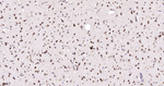RANGAP1 Antibody in Immunohistochemistry (Paraffin) (IHC (P))