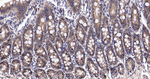 RANGAP1 Antibody in Immunohistochemistry (Paraffin) (IHC (P))