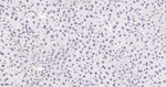 RANGAP1 Antibody in Immunohistochemistry (Paraffin) (IHC (P))
