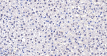 RANGAP1 Antibody in Immunohistochemistry (Paraffin) (IHC (P))