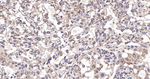 RANGAP1 Antibody in Immunohistochemistry (Paraffin) (IHC (P))
