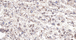 RANGAP1 Antibody in Immunohistochemistry (Paraffin) (IHC (P))