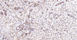 DIAPH1 Antibody in Immunohistochemistry (Paraffin) (IHC (P))