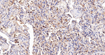 DIAPH1 Antibody in Immunohistochemistry (Paraffin) (IHC (P))