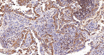 DIAPH1 Recombinant Rabbit Monoclonal Antibody (7A10)