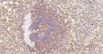 DIAPH1 Antibody in Immunohistochemistry (Paraffin) (IHC (P))