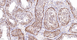 DIAPH1 Antibody in Immunohistochemistry (Paraffin) (IHC (P))
